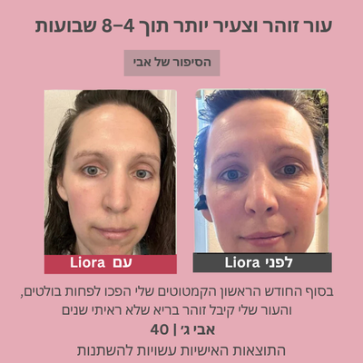 Liora | מסכת חידוש