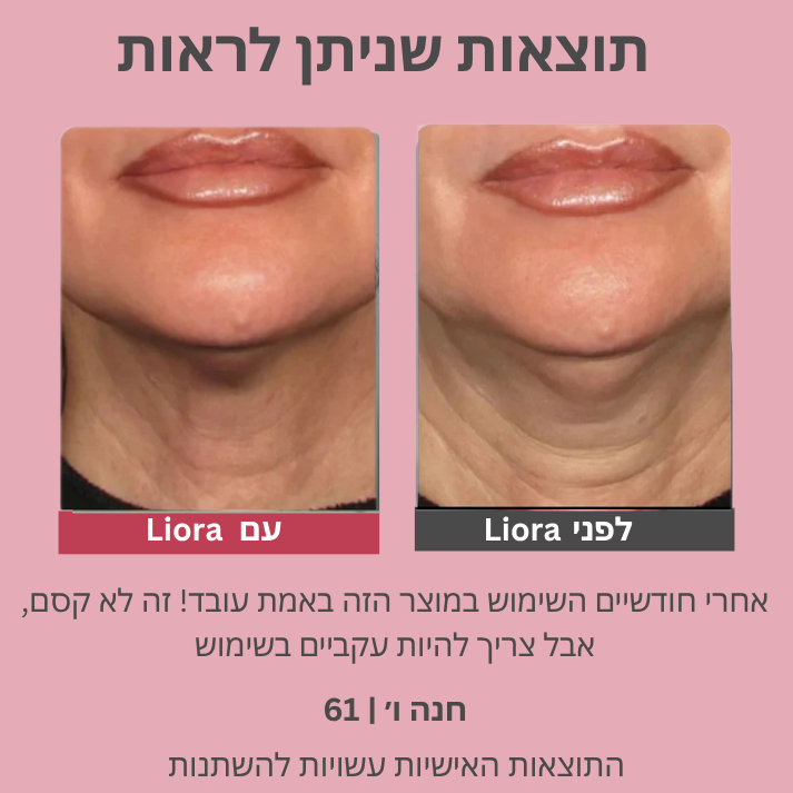 Liora | מסכת חידוש