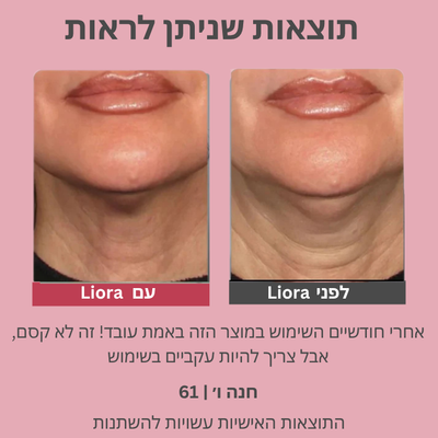 Liora | מסכת חידוש