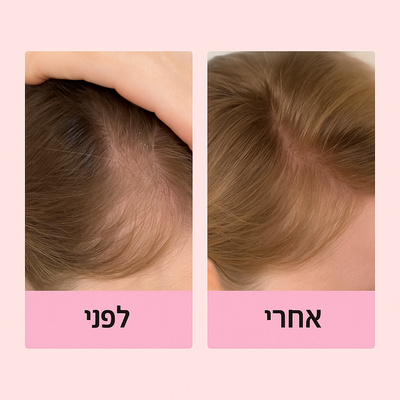 Liora Botanica | סרום לשיער לצמיחה טבעית ומראה מלא ובריא