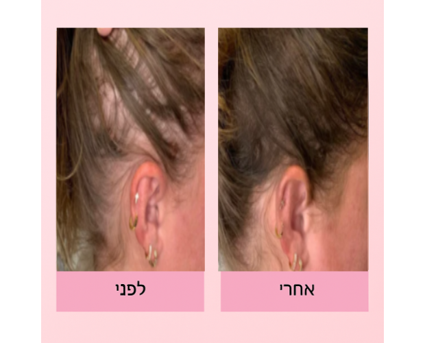 Liora Botanica | סרום לשיער לצמיחה טבעית ומראה מלא ובריא